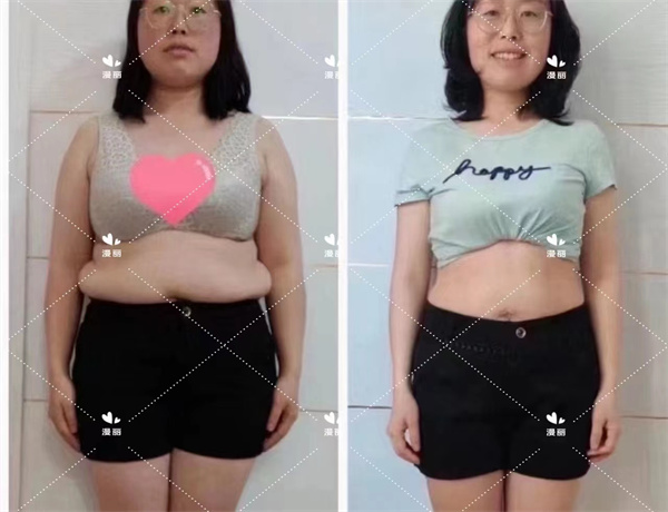 瘦身成功案例