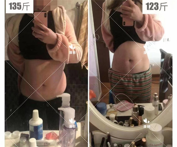 瘦身成功案例